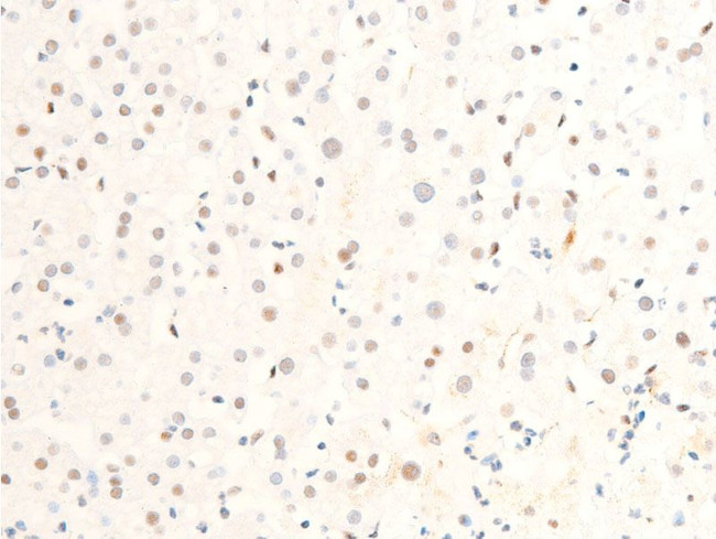 Phospho-c-Myc (Ser62) Antibody in Immunohistochemistry (Paraffin) (IHC (P))