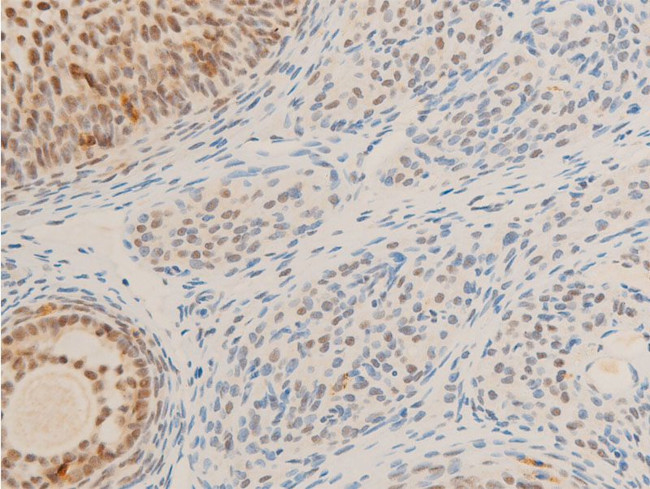 Phospho-c-Myc (Ser62) Antibody in Immunohistochemistry (Paraffin) (IHC (P))