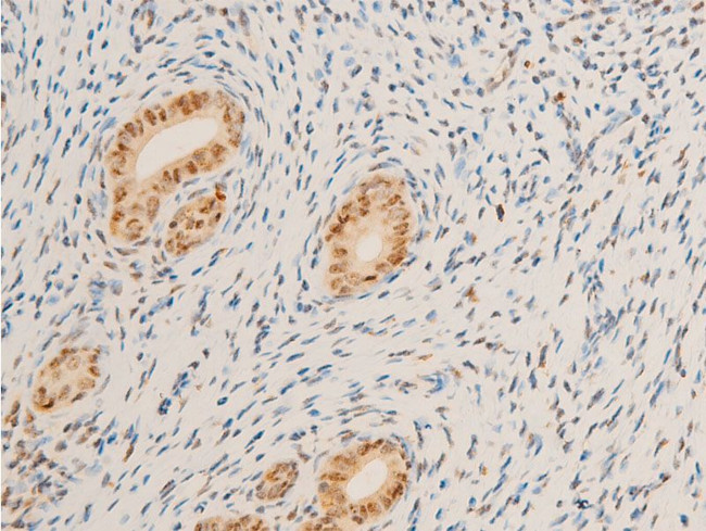 Phospho-c-Myc (Ser62) Antibody in Immunohistochemistry (Paraffin) (IHC (P))