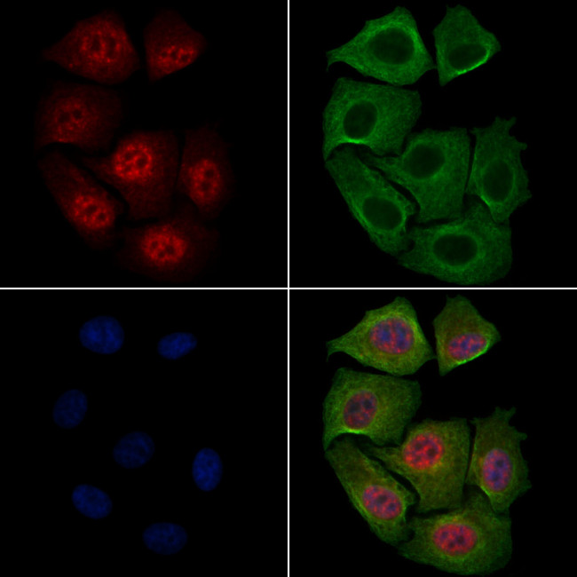 Phospho-c-Myc (Thr58) Antibody in Immunocytochemistry (ICC/IF)