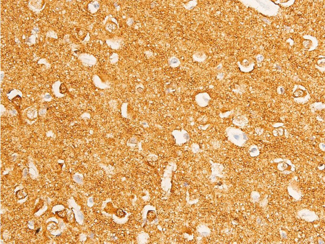 Phospho-c-Myc (Thr58) Antibody in Immunohistochemistry (Paraffin) (IHC (P))