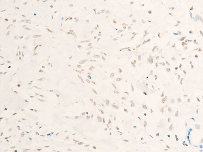 Phospho-c-Myc (Thr58) Antibody in Immunohistochemistry (Paraffin) (IHC (P))