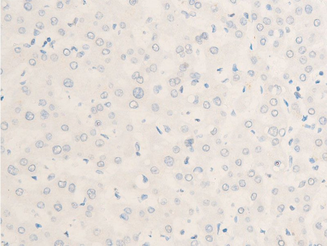 Phospho-c-Myc (Thr58) Antibody in Immunohistochemistry (Paraffin) (IHC (P))