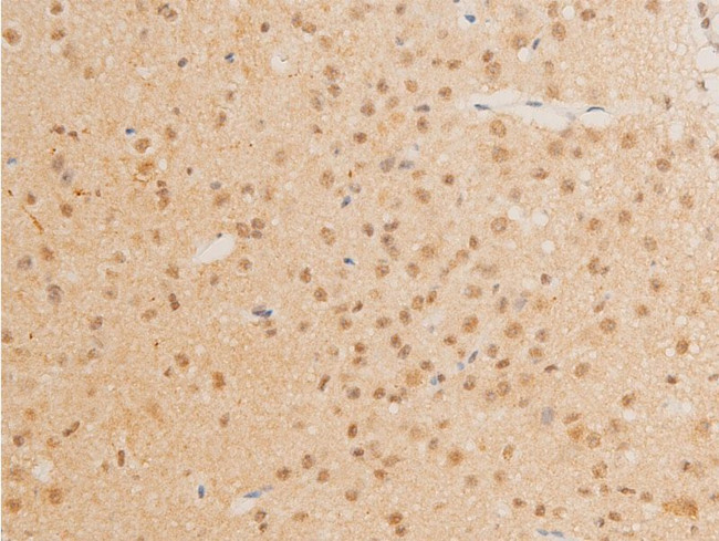 Phospho-c-Myc (Thr58) Antibody in Immunohistochemistry (Paraffin) (IHC (P))