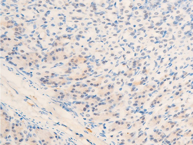 Phospho-c-Myc (Thr58) Antibody in Immunohistochemistry (Paraffin) (IHC (P))