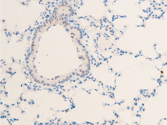 Phospho-c-Myc (Thr58) Antibody in Immunohistochemistry (Paraffin) (IHC (P))