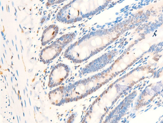 Phospho-c-Myc (Thr58) Antibody in Immunohistochemistry (Paraffin) (IHC (P))