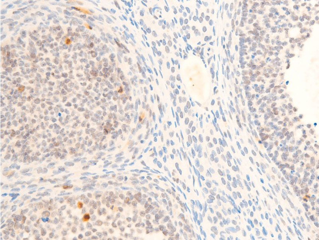 Phospho-c-Myc (Thr58) Antibody in Immunohistochemistry (Paraffin) (IHC (P))