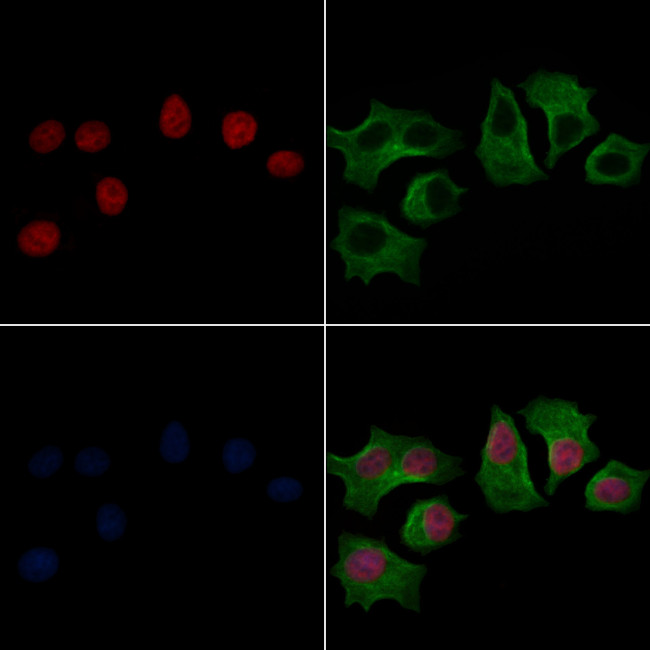 Phospho-Lamin A/C (Ser392) Antibody in Immunocytochemistry (ICC/IF)