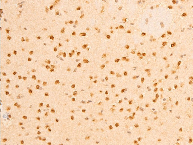 Phospho-Lamin A/C (Ser392) Antibody in Immunohistochemistry (Paraffin) (IHC (P))