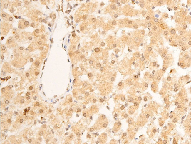 Phospho-Lamin A/C (Ser392) Antibody in Immunohistochemistry (Paraffin) (IHC (P))