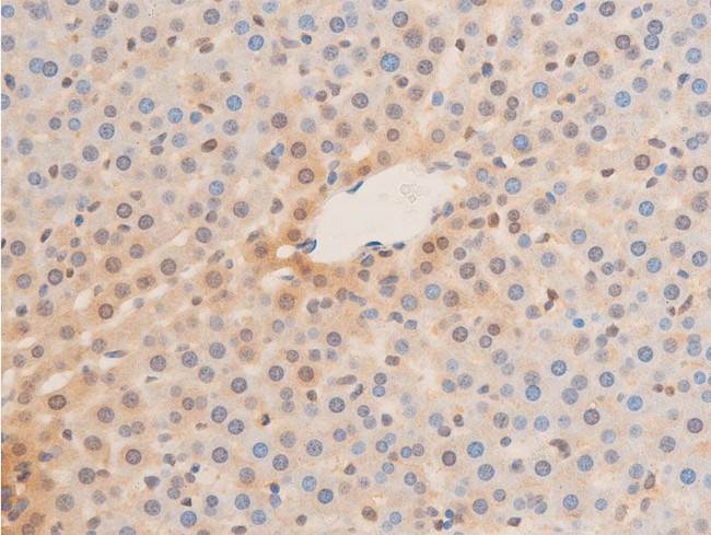 Phospho-Lamin A/C (Ser392) Antibody in Immunohistochemistry (Paraffin) (IHC (P))