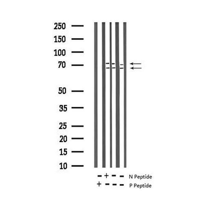 Phospho-Lamin A/C (Ser392) Antibody in Western Blot (WB)