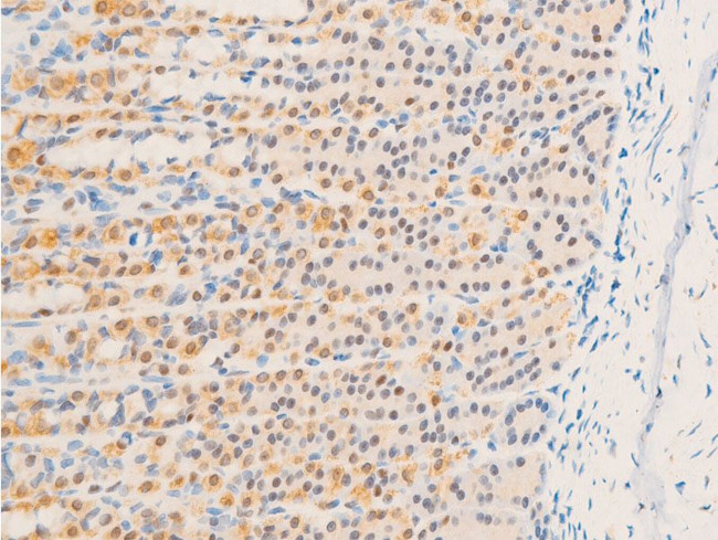 Phospho-Glucocorticoid Receptor (Ser226) Antibody in Immunohistochemistry (Paraffin) (IHC (P))