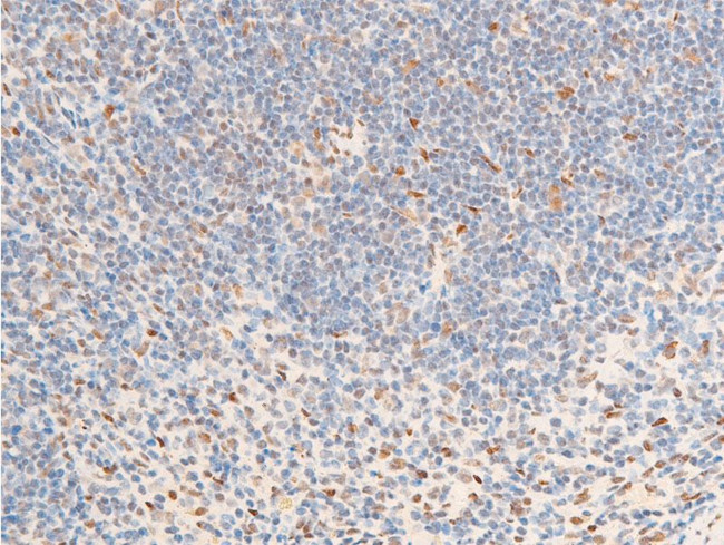 Phospho-Glucocorticoid Receptor (Ser226) Antibody in Immunohistochemistry (Paraffin) (IHC (P))