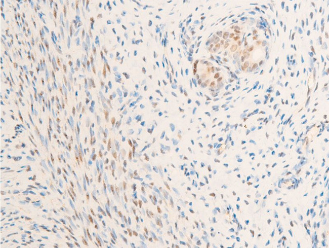 Phospho-Glucocorticoid Receptor (Ser226) Antibody in Immunohistochemistry (Paraffin) (IHC (P))