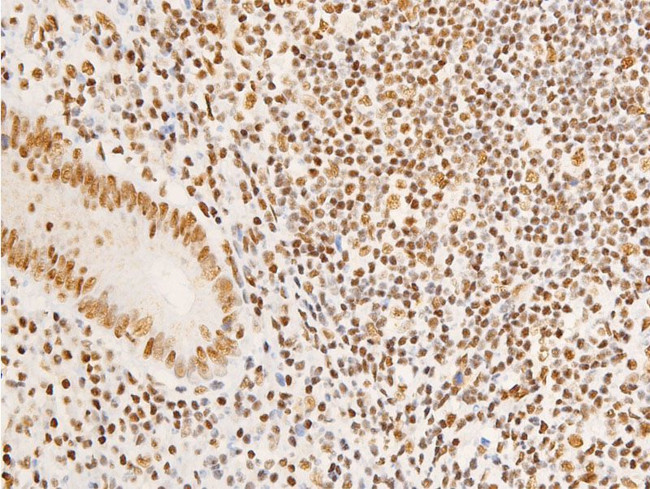 Phospho-Glucocorticoid Receptor (Ser203) Antibody in Immunohistochemistry (Paraffin) (IHC (P))