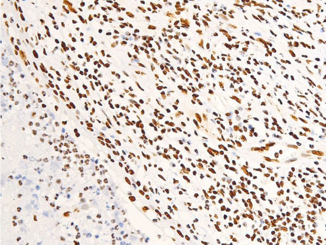 Phospho-Glucocorticoid Receptor (Ser203) Antibody in Immunohistochemistry (Paraffin) (IHC (P))