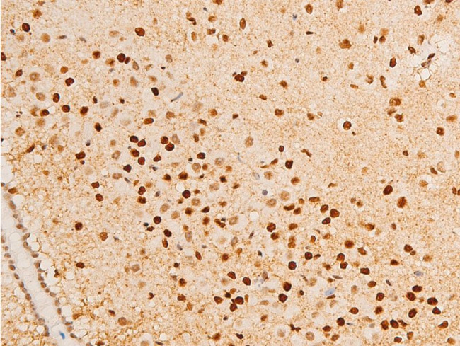 Phospho-Glucocorticoid Receptor (Ser203) Antibody in Immunohistochemistry (Paraffin) (IHC (P))