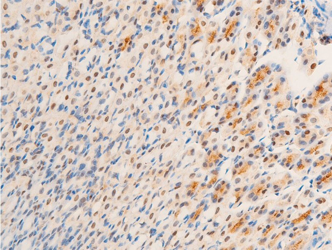 Phospho-Glucocorticoid Receptor (Ser203) Antibody in Immunohistochemistry (Paraffin) (IHC (P))