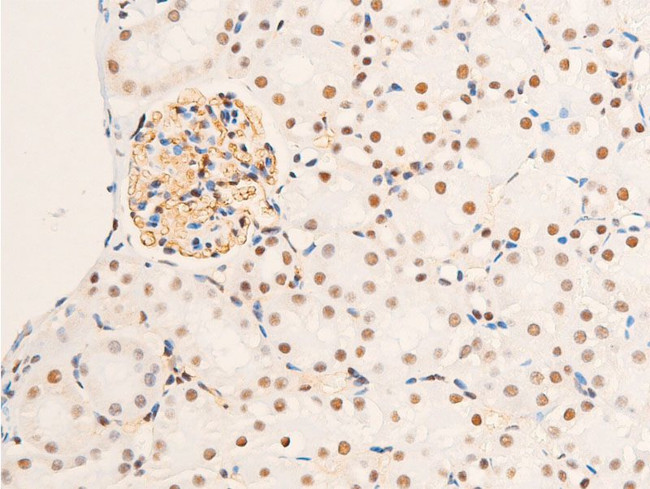 Phospho-Glucocorticoid Receptor (Ser203) Antibody in Immunohistochemistry (Paraffin) (IHC (P))