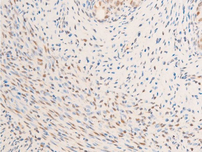 Phospho-Glucocorticoid Receptor (Ser203) Antibody in Immunohistochemistry (Paraffin) (IHC (P))