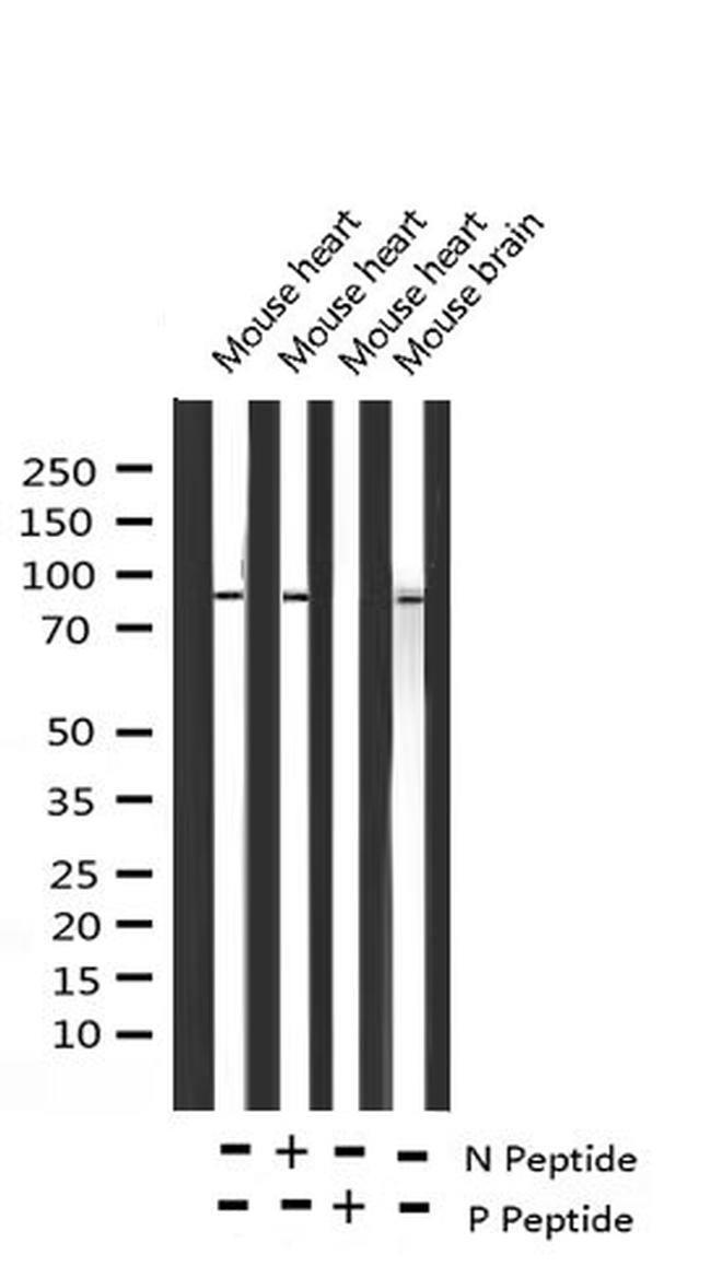 Phospho-Glucocorticoid Receptor (Ser203) Antibody in Western Blot (WB)