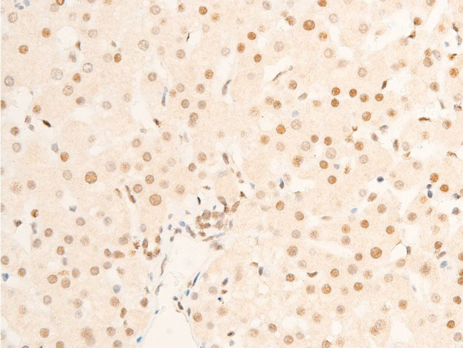 Phospho-TK1 (Ser13) Antibody in Immunohistochemistry (Paraffin) (IHC (P))