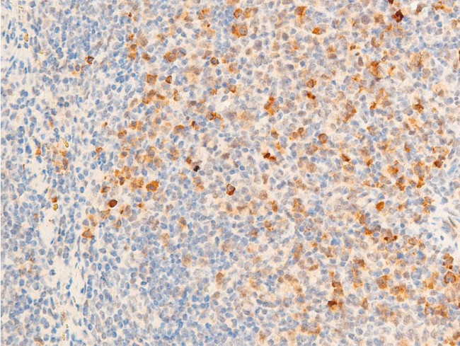 Phospho-TK1 (Ser13) Antibody in Immunohistochemistry (Paraffin) (IHC (P))