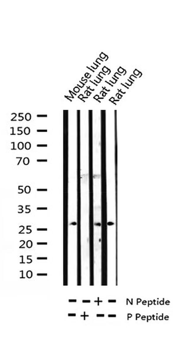 Phospho-TK1 (Ser13) Antibody in Western Blot (WB)