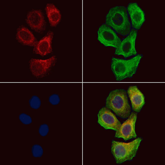 Phospho-ErbB2 (HER-2) (Tyr877) Antibody in Immunocytochemistry (ICC/IF)