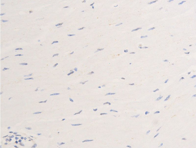 Phospho-ErbB2 (HER-2) (Tyr877) Antibody in Immunohistochemistry (Paraffin) (IHC (P))