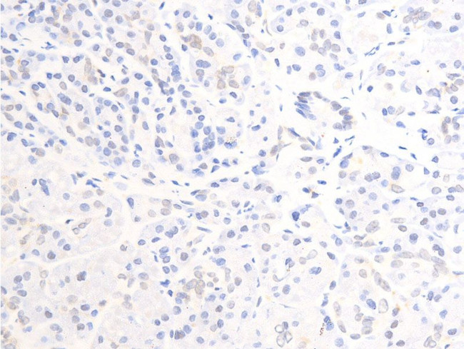 Phospho-ErbB2 (HER-2) (Tyr877) Antibody in Immunohistochemistry (Paraffin) (IHC (P))