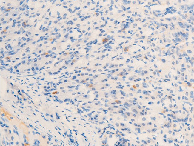 Phospho-ErbB2 (HER-2) (Tyr877) Antibody in Immunohistochemistry (Paraffin) (IHC (P))