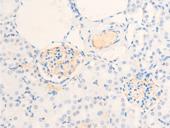 Phospho-ErbB2 (HER-2) (Tyr877) Antibody in Immunohistochemistry (Paraffin) (IHC (P))