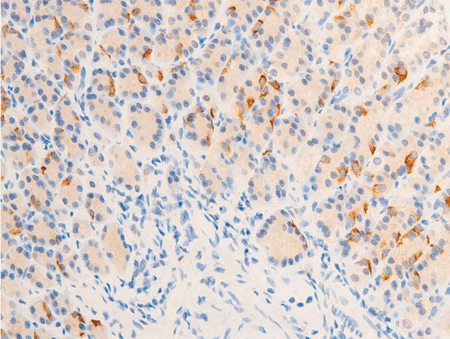 Phospho-ErbB2 (HER-2) (Tyr877) Antibody in Immunohistochemistry (Paraffin) (IHC (P))