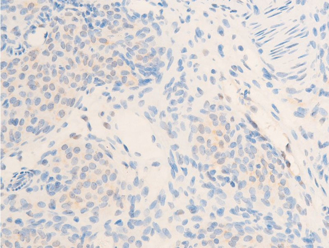 Phospho-ErbB2 (HER-2) (Tyr877) Antibody in Immunohistochemistry (Paraffin) (IHC (P))