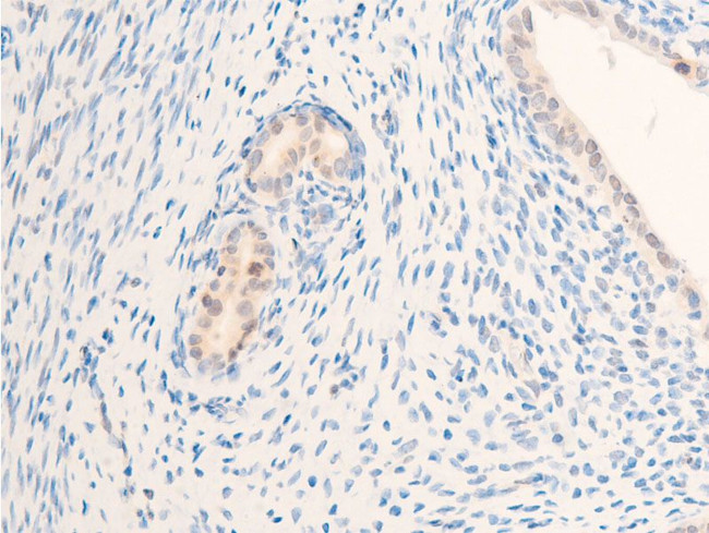 Phospho-ErbB2 (HER-2) (Tyr877) Antibody in Immunohistochemistry (Paraffin) (IHC (P))