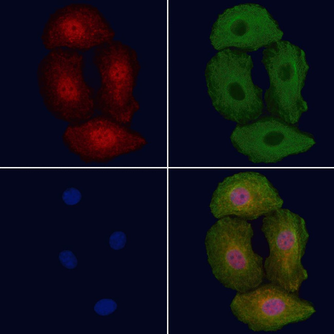 Phospho-ErbB2 (HER-2) (Tyr1112) Antibody in Immunocytochemistry (ICC/IF)