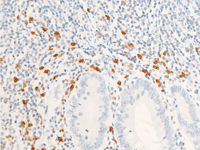 Phospho-ErbB2 (HER-2) (Tyr1112) Antibody in Immunohistochemistry (Paraffin) (IHC (P))