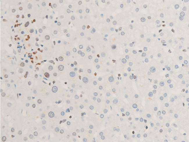 Phospho-ErbB2 (HER-2) (Tyr1112) Antibody in Immunohistochemistry (Paraffin) (IHC (P))