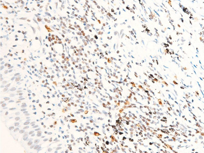 Phospho-ErbB2 (HER-2) (Tyr1112) Antibody in Immunohistochemistry (Paraffin) (IHC (P))