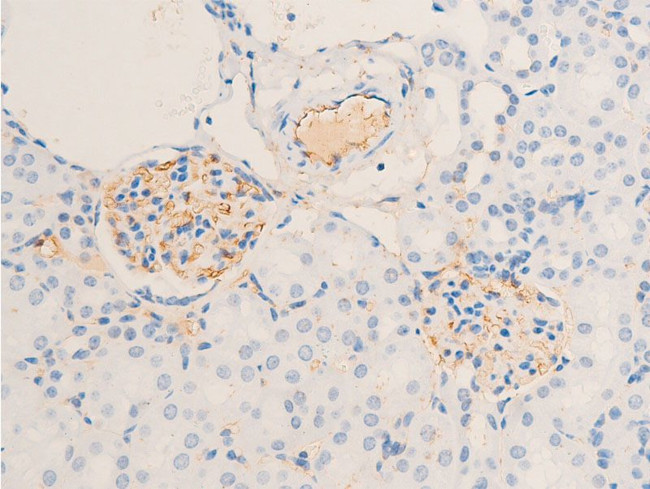 Phospho-ErbB2 (HER-2) (Tyr1112) Antibody in Immunohistochemistry (Paraffin) (IHC (P))