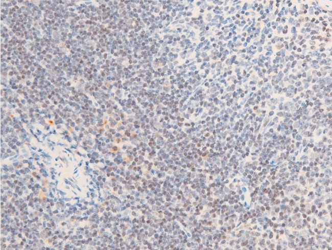 Phospho-ErbB2 (HER-2) (Tyr1112) Antibody in Immunohistochemistry (Paraffin) (IHC (P))