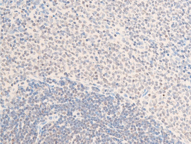 Phospho-ErbB2 (HER-2) (Tyr1112) Antibody in Immunohistochemistry (Paraffin) (IHC (P))