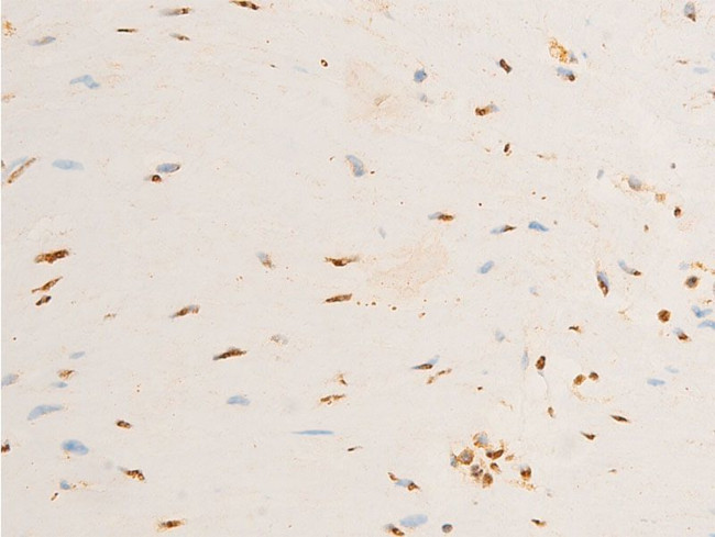 Phospho-TrkA (Tyr680, Tyr681) Antibody in Immunohistochemistry (Paraffin) (IHC (P))