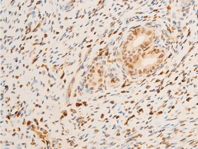 Phospho-TrkA (Tyr680, Tyr681) Antibody in Immunohistochemistry (Paraffin) (IHC (P))