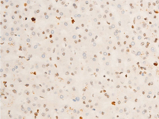 Phospho-TrkA (Tyr680, Tyr681) Antibody in Immunohistochemistry (Paraffin) (IHC (P))