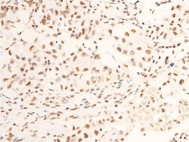 Phospho-TrkA (Tyr680, Tyr681) Antibody in Immunohistochemistry (Paraffin) (IHC (P))