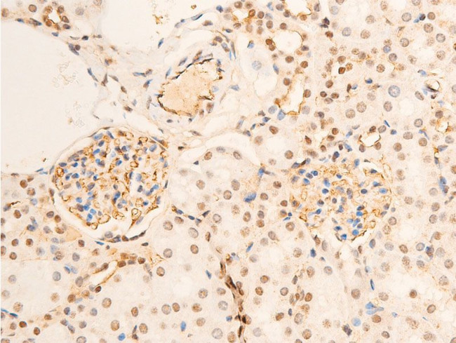 Phospho-TrkA (Tyr680, Tyr681) Antibody in Immunohistochemistry (Paraffin) (IHC (P))